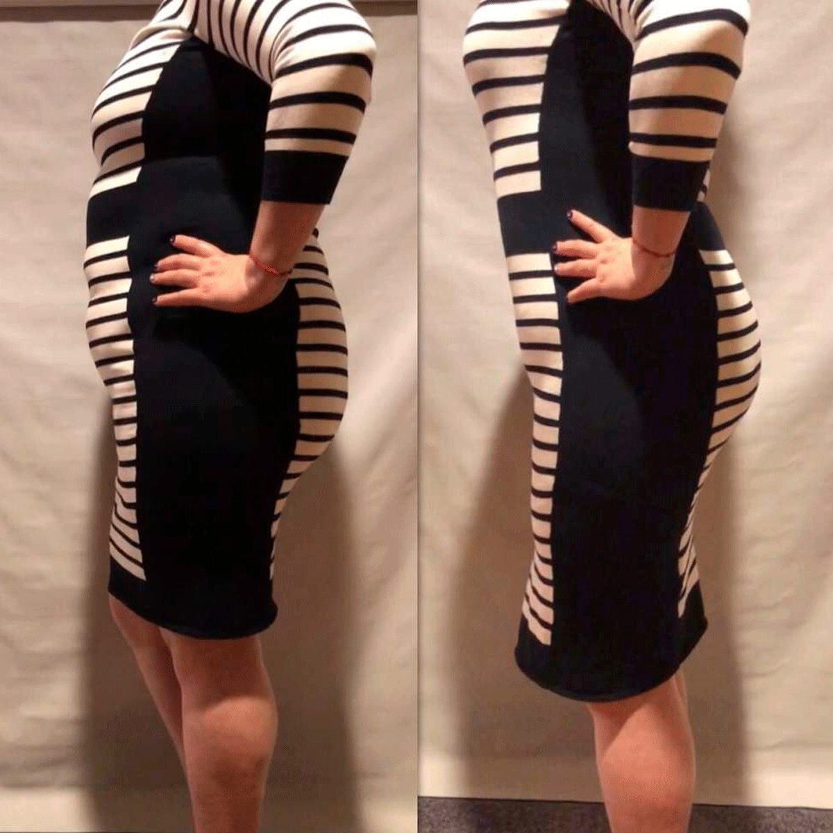 [V-026] Faja Body Moldeadora Vicky post operatoria o diaria