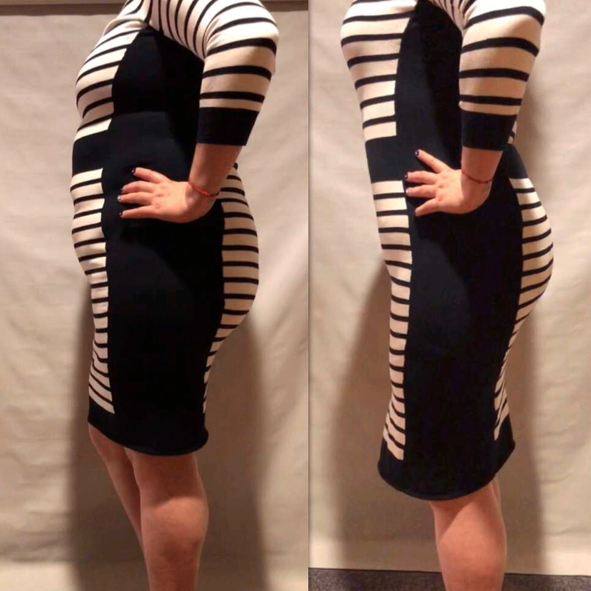 [V-046] Faja reductora con mangas corrector de postura Vicky