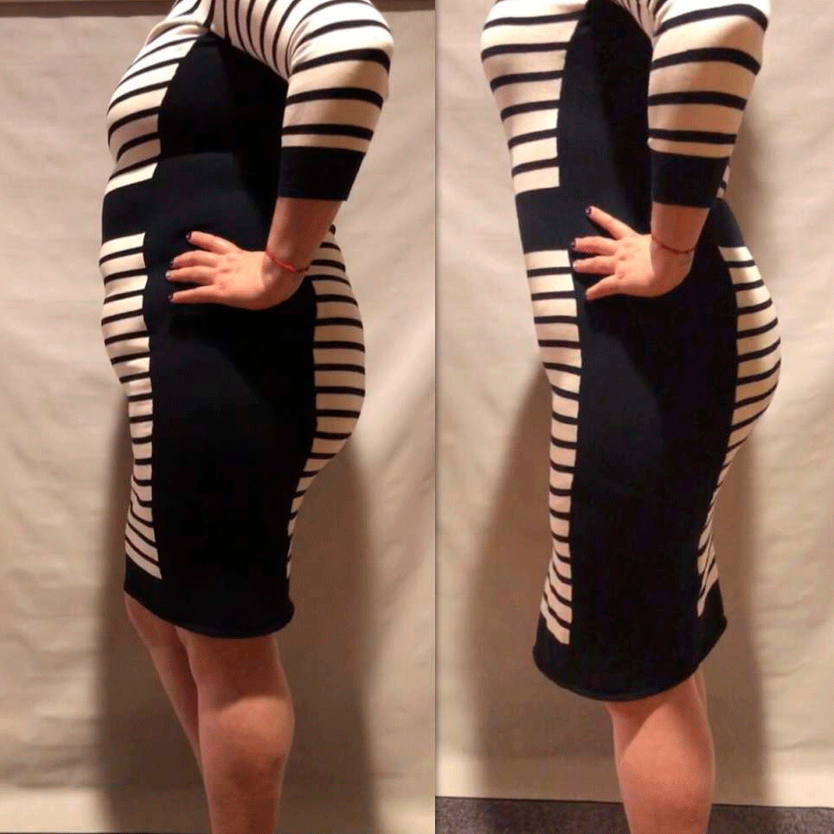 [V-062] Faja Post Cirugia Post Parto Reductor y Moldeador